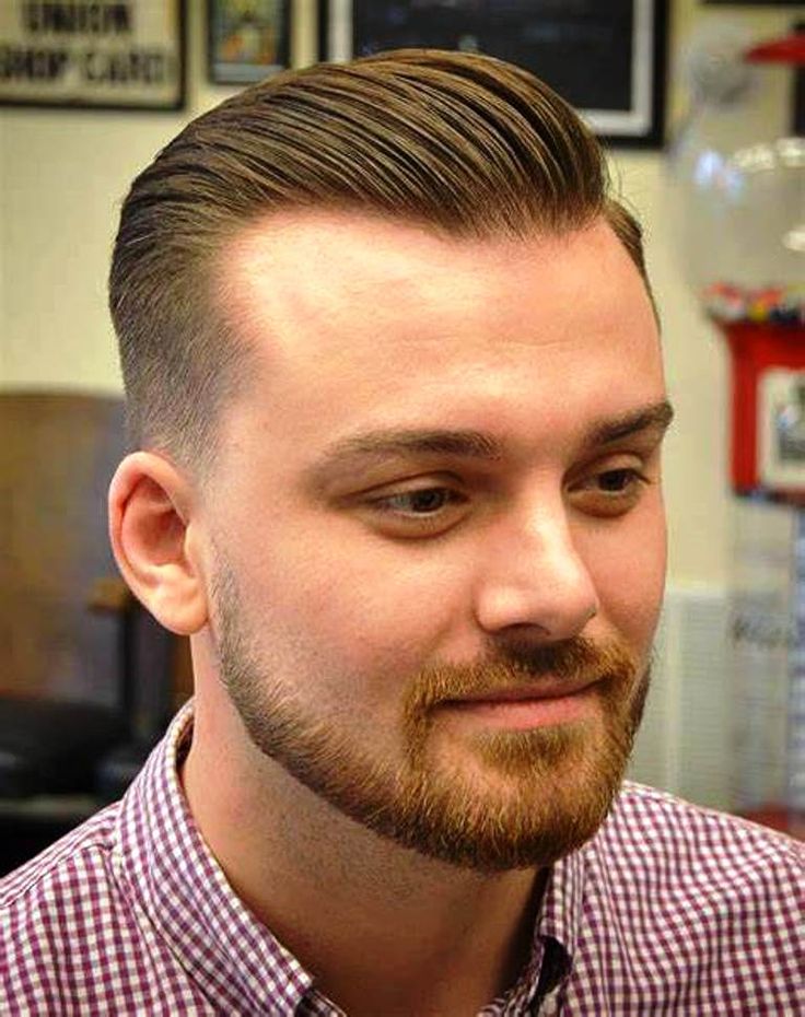 receding hairline hairstyles